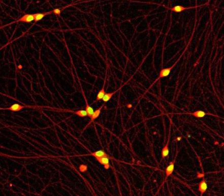 인간 유래 iPS 세포에서 분화된 고순도 감각 신경 세포 출시! iCell Sensory Neurons