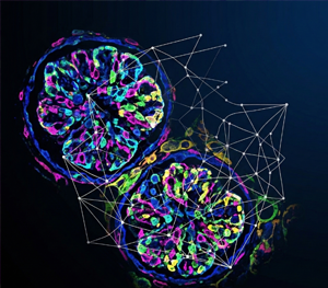 [Omics View] 사구체염에서 밝혀진 면역세포 간 ‘공간적 상호작용’의 결정적 역할 | Vol.3