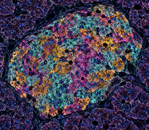 [Omics View] Spatial Proteomics로 보는 췌장 섬의 세포 다양성 | Vol.10